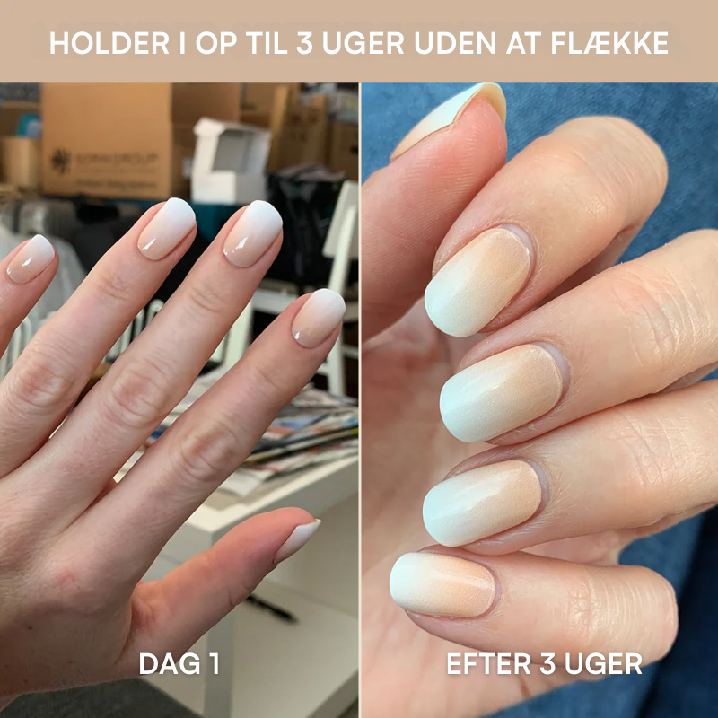 Startpakke til Negle